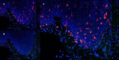 Anti-CD1a antibody [NA1/34-HLK] used in IHC (Frozen sections) (IHC-Fr). GTX76536