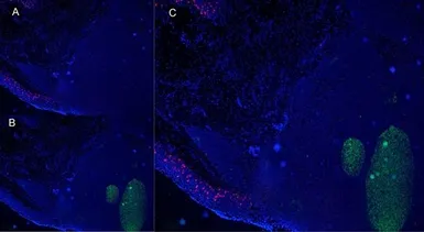 Anti-CD1a antibody [NA1/34-HLK] used in IHC (Frozen sections) (IHC-Fr). GTX76536