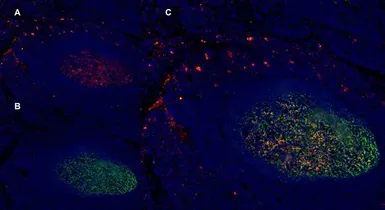 Anti-CD1a antibody [NA1/34-HLK] used in IHC (Frozen sections) (IHC-Fr). GTX76536