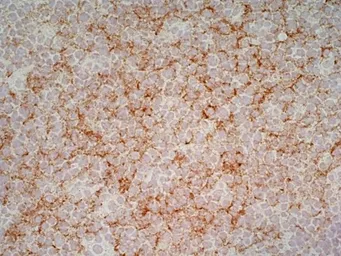 Anti-CD1a antibody [NA1/34-HLK] used in IHC (Frozen sections) (IHC-Fr). GTX76536