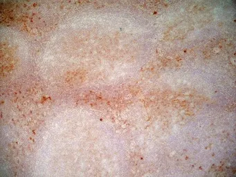 Anti-CD1a antibody [NA1/34-HLK] used in IHC (Frozen sections) (IHC-Fr). GTX76536