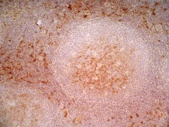 Anti-CD1a antibody [NA1/34-HLK] used in IHC (Frozen sections) (IHC-Fr). GTX76536