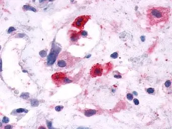 Rabbit Anti-Cat Whole Serum antibody. GTX77115