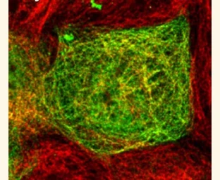 Anti-6X His tag antibody used in Immunocytochemistry/ Immunofluorescence (ICC/IF). GTX77352