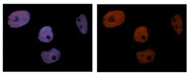 Anti-PCNA antibody, C-term used in Immunocytochemistry/ Immunofluorescence (ICC/IF). GTX77666