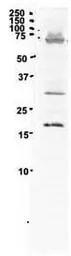 Anti-PCNA antibody, C-term used in Western Blot (WB). GTX77666
