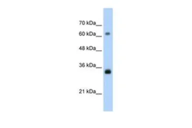 Anti-PCNA antibody, C-term used in Western Blot (WB). GTX77666