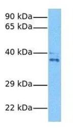 Anti-Cyclin G2 antibody, N-term used in Western Blot (WB). GTX77670