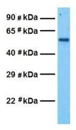 Anti-GABA A Receptor delta antibody, N-term used in Western Blot (WB). GTX77695