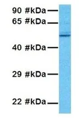 Anti-GABA A Receptor pi antibody, N-term used in Western Blot (WB). GTX77697