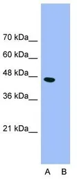 Anti-GABA A Receptor pi antibody, N-term used in Western Blot (WB). GTX77697
