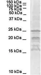 Anti-SNAP25 antibody, C-term used in Western Blot (WB). GTX77715