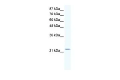 Anti-RGS10 antibody, Internal used in Western Blot (WB). GTX77730