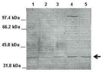 Anti-IKB alpha antibody, Internal used in Western Blot (WB). GTX77737
