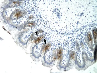 Anti-TEL antibody, C-term used in IHC (Paraffin sections) (IHC-P). GTX77770
