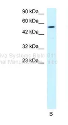 Anti-HLX1 antibody, Internal used in Western Blot (WB). GTX77776