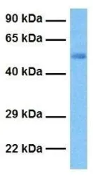 Anti-HLX1 antibody, Internal used in Western Blot (WB). GTX77776