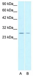 Anti-ZNF174 antibody, N-term used in Western Blot (WB). GTX77782