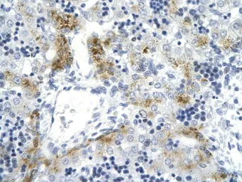 Anti-Topoisomerase II alpha antibody, C-term used in IHC (Paraffin sections) (IHC-P). GTX77787