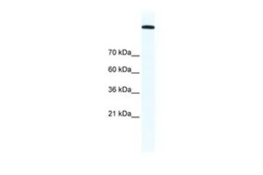 Anti-Topoisomerase II alpha antibody, C-term used in Western Blot (WB). GTX77787