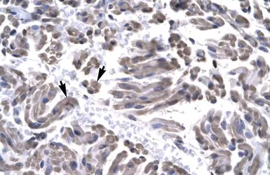 Anti-TFIIH p34 antibody, N-term used in IHC (Paraffin sections) (IHC-P). GTX77809