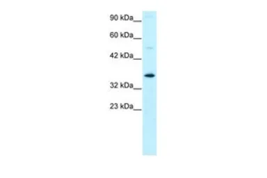 Anti-TFIIH p34 antibody, N-term used in Western Blot (WB). GTX77809