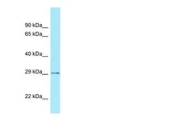 Anti-CDX2 antibody, Internal used in Western Blot (WB). GTX77810