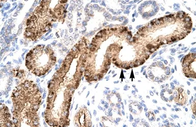 Anti-Steroidogenic Factor 1 antibody, Internal used in IHC (Paraffin sections) (IHC-P). GTX77813