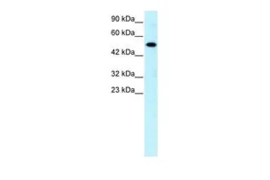 Anti-Steroidogenic Factor 1 antibody, Internal used in Western Blot (WB). GTX77813