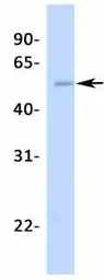 Anti-Steroidogenic Factor 1 antibody, Internal used in Western Blot (WB). GTX77813