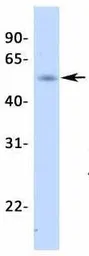 Anti-Steroidogenic Factor 1 antibody, Internal used in Western Blot (WB). GTX77813