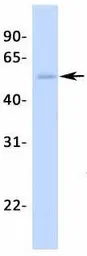 Anti-Steroidogenic Factor 1 antibody, Internal used in Western Blot (WB). GTX77813