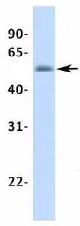 Anti-Steroidogenic Factor 1 antibody, Internal used in Western Blot (WB). GTX77813