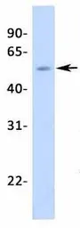 Anti-Steroidogenic Factor 1 antibody, Internal used in Western Blot (WB). GTX77813