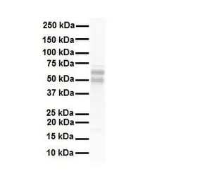 Anti-Steroidogenic Factor 1 antibody, Internal used in Western Blot (WB). GTX77813
