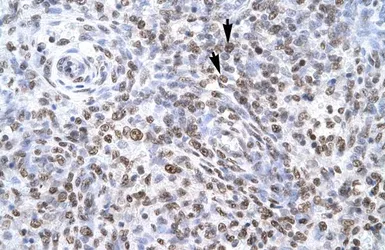 Anti-ZNF500 antibody, Internal used in IHC (Paraffin sections) (IHC-P). GTX77814