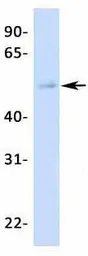 Anti-LBP9 antibody, N-term used in Western Blot (WB). GTX77815