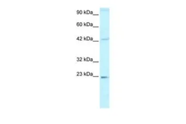 Anti-HMGB2 antibody, C-term used in Western Blot (WB). GTX77816