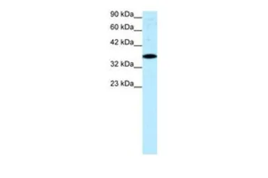 Anti-NUR77 antibody, N-term used in Western Blot (WB). GTX77817