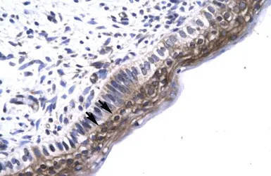 Anti-TAB2 antibody, N-term used in IHC (Paraffin sections) (IHC-P). GTX77824