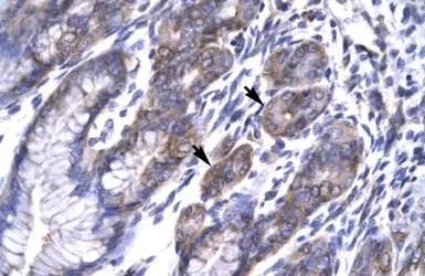 Anti-TAB2 antibody, N-term used in IHC (Paraffin sections) (IHC-P). GTX77824
