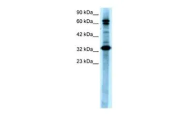 Anti-TAB2 antibody, N-term used in Western Blot (WB). GTX77824