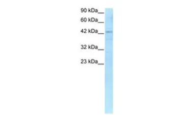 Anti-RBPJK antibody, C-term used in Western Blot (WB). GTX77825