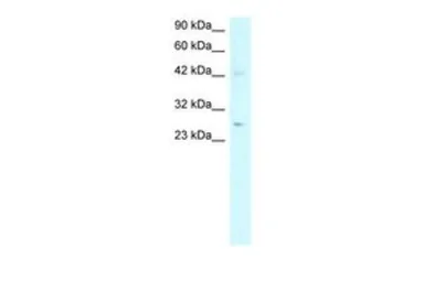 Anti-Adiponectin antibody, N-term used in Western Blot (WB). GTX77828