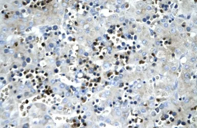 Anti-SCD antibody, Internal used in IHC (Paraffin sections) (IHC-P). GTX77829