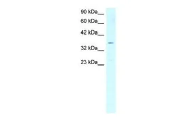 Anti-SCD antibody, Internal used in Western Blot (WB). GTX77829