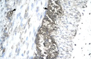 Anti-ACAT2 antibody, Internal used in IHC (Paraffin sections) (IHC-P). GTX77830