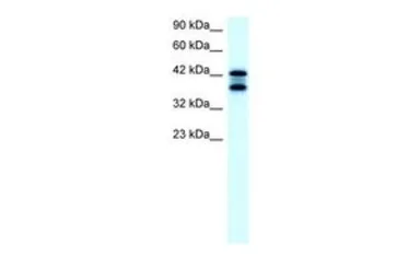 Anti-ACAT2 antibody, Internal used in Western Blot (WB). GTX77830
