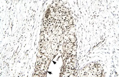 Anti-RUVBL2 antibody, N-term used in IHC (Paraffin sections) (IHC-P). GTX77831