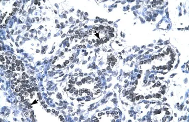 Anti-RUVBL2 antibody, N-term used in IHC (Paraffin sections) (IHC-P). GTX77831